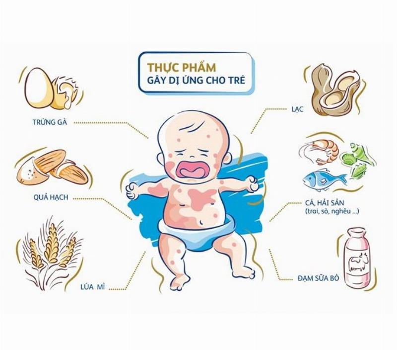 ky nang doc nhan mac thuc pham cho tre di ung